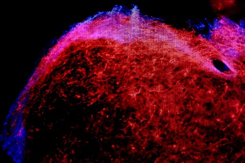the universe of the brain — 写真 2